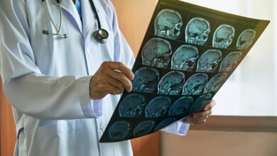 Doctor with stethoscope holding human brain MRI imaging in medical office