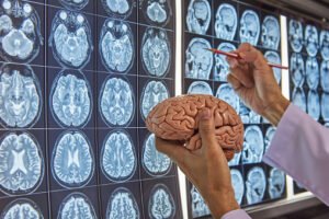 A neurosurgeon holding human brain model and pointing at brain MRI on lightbox in medical office